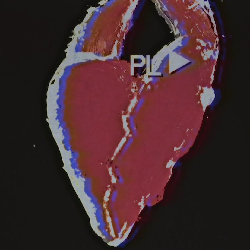 los mellox nyc pa que amor (1)